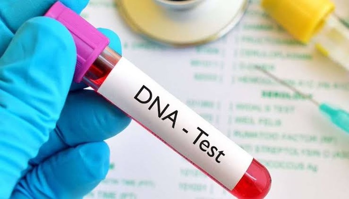 dna-test