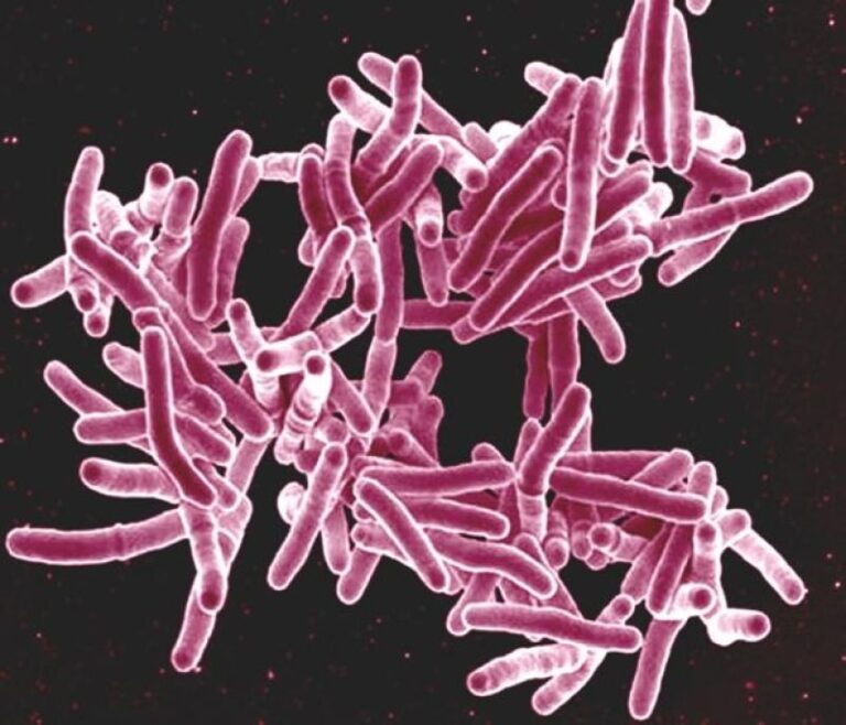 tuberculosis_bacteria_f